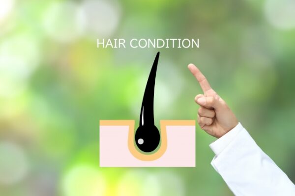 白髪対策の成分のイメージ画像